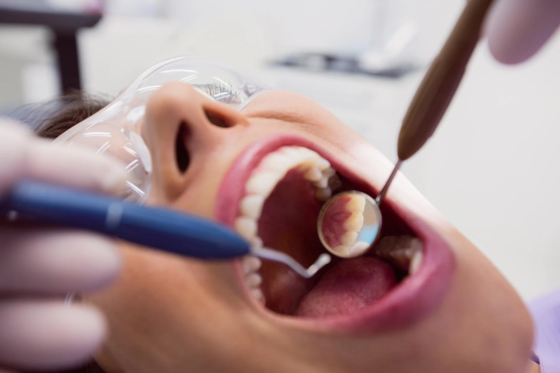 The Role of 3D Imaging and Digital Planning in Zygomatic Implant Surgery