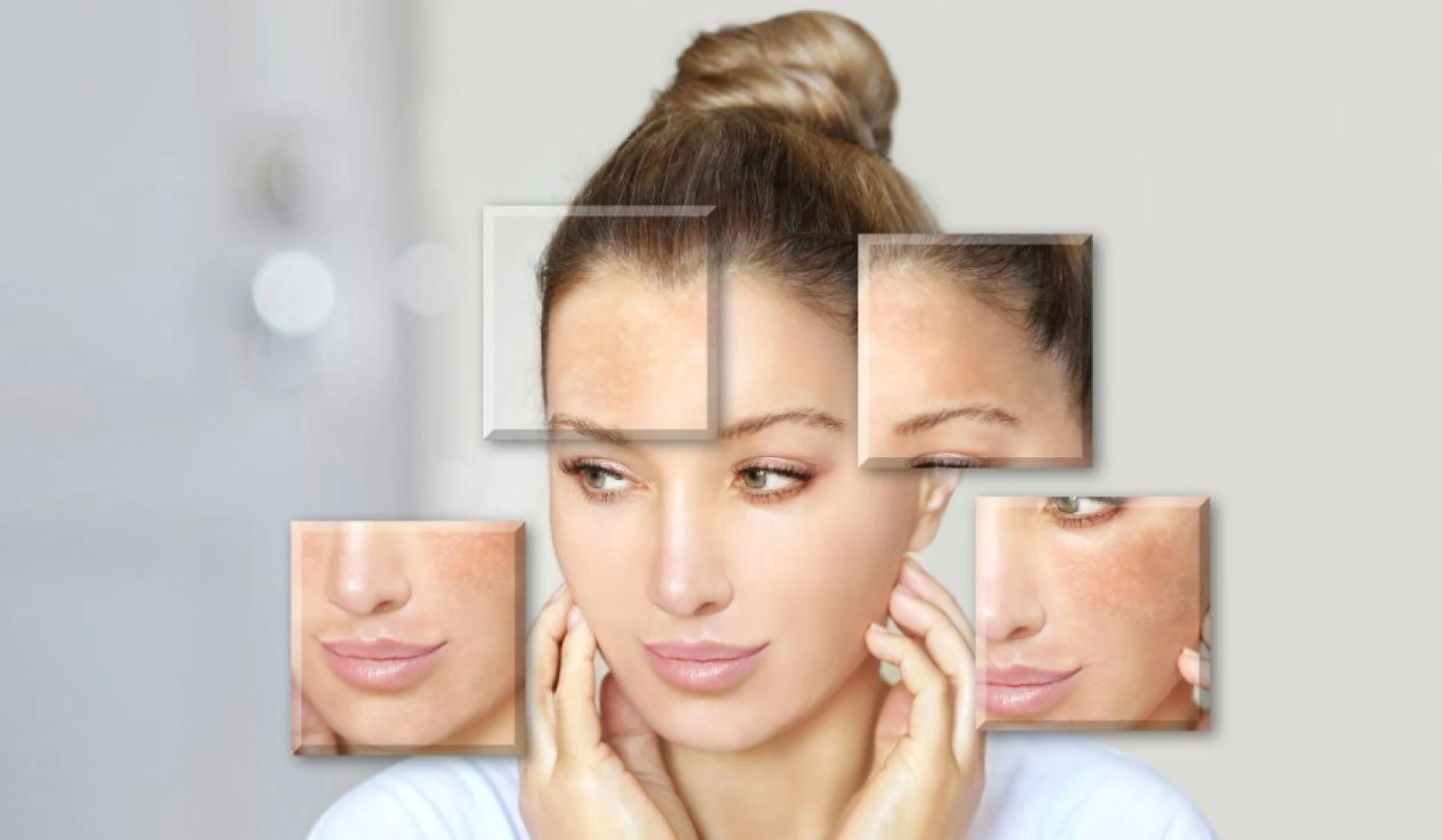 VCare’s Open Pores Treatment: Expert Care for Healthy Skin