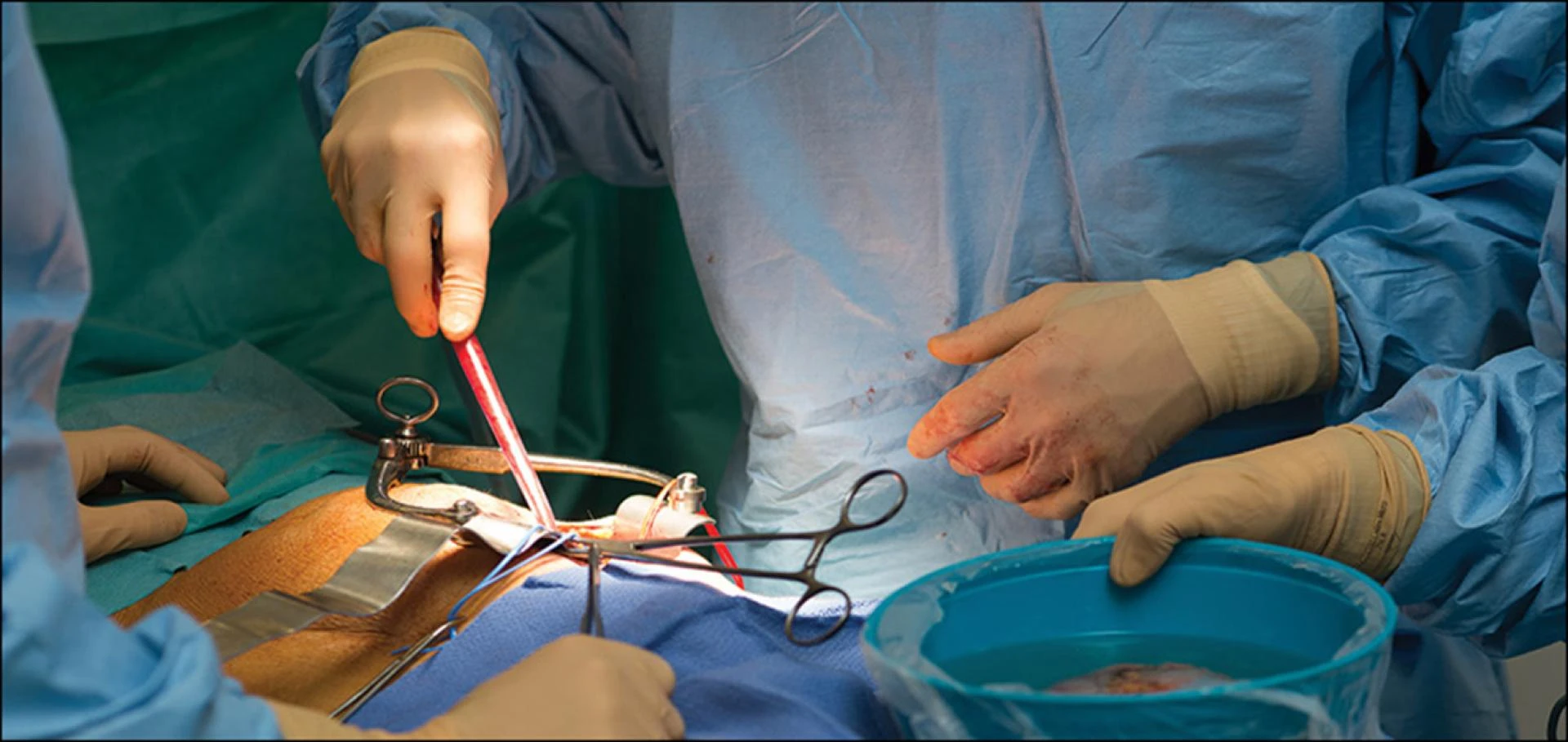 Expert Kidney Transplant Clinic Offering Comprehensive Renal Care