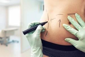 Medical Tourism and Tummy Tucks: Why Dubai Leads the Way