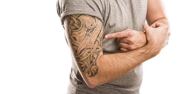 Tattoo Removal in Coventry: What You Need to Know