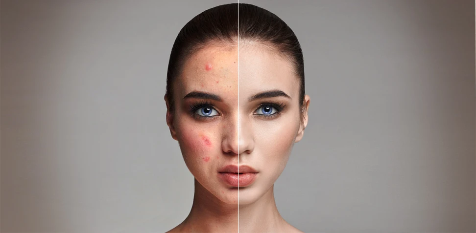 Why Photo Retouching & Editing Services Are More Vital in 2026