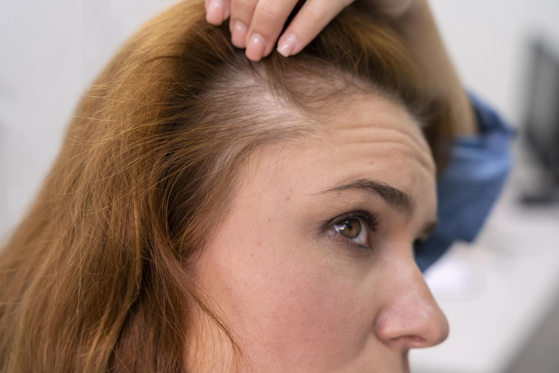 Unlocking Hair Growth: A Complete Guide to Hair Growth Therapy from Theradome