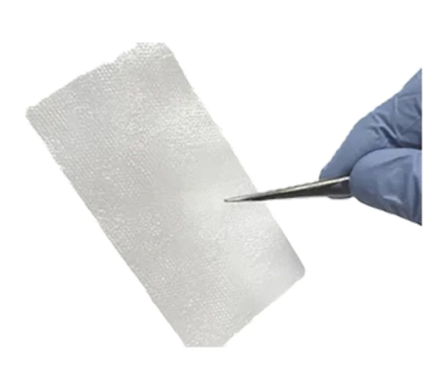 How Amniotic Allografts Are Transforming Advanced Wound Care Today