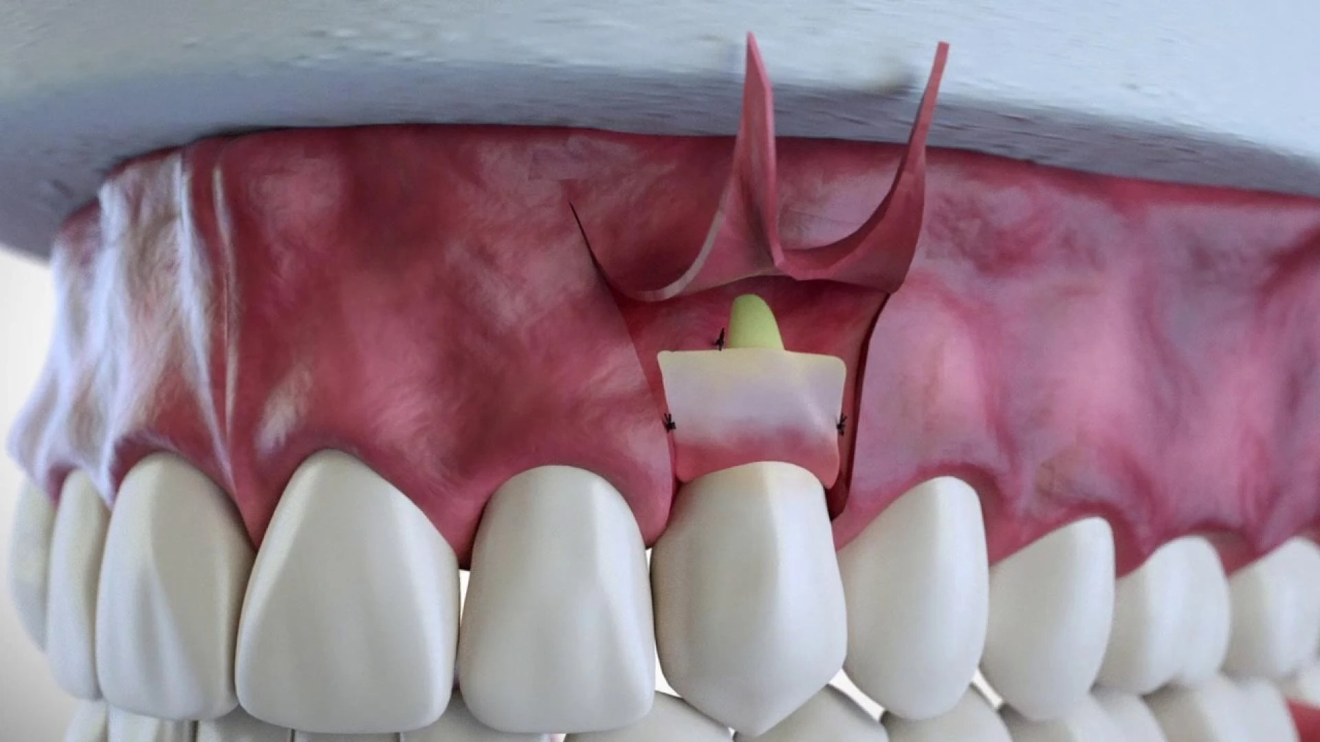 How to Choose the Best Dentist in Murphy: A Complete Guide