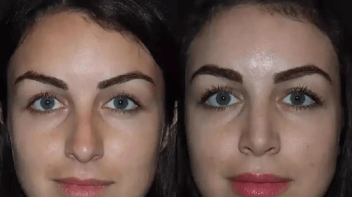 Best Rhinoplasty Surgeons in Dubai Leading Cosmetic Nose Surgery