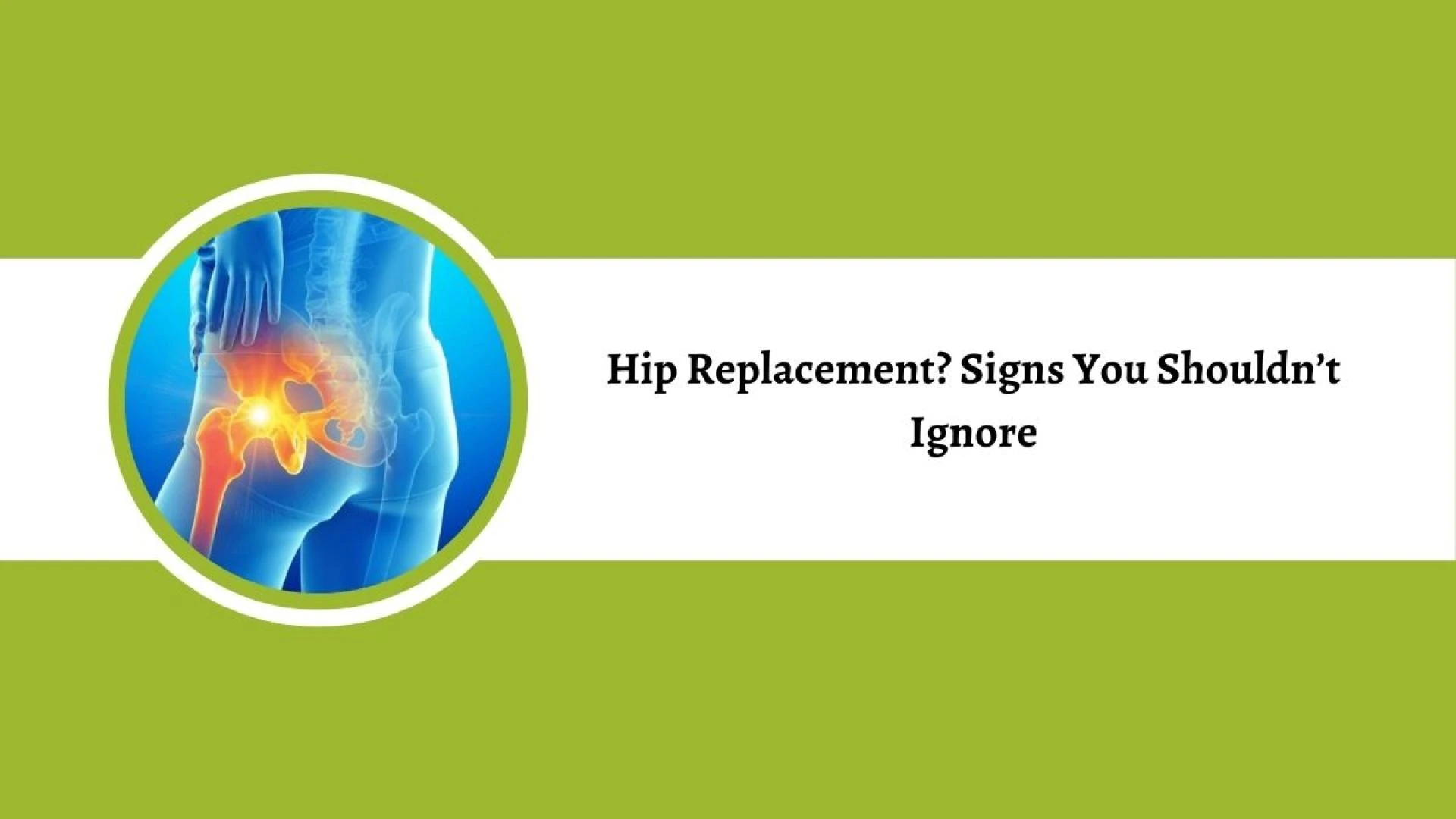 When Do You Need Hip Replacement? Signs You Shouldn’t Ignore