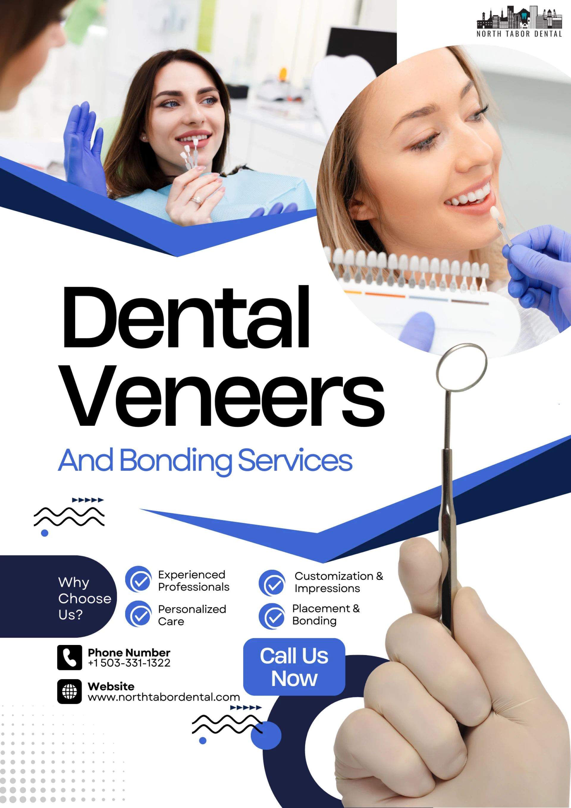 What Are Dental Veneers Procedure?