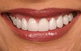 Why More Residents Are Choosing a Cosmetic Dentist in The Colony