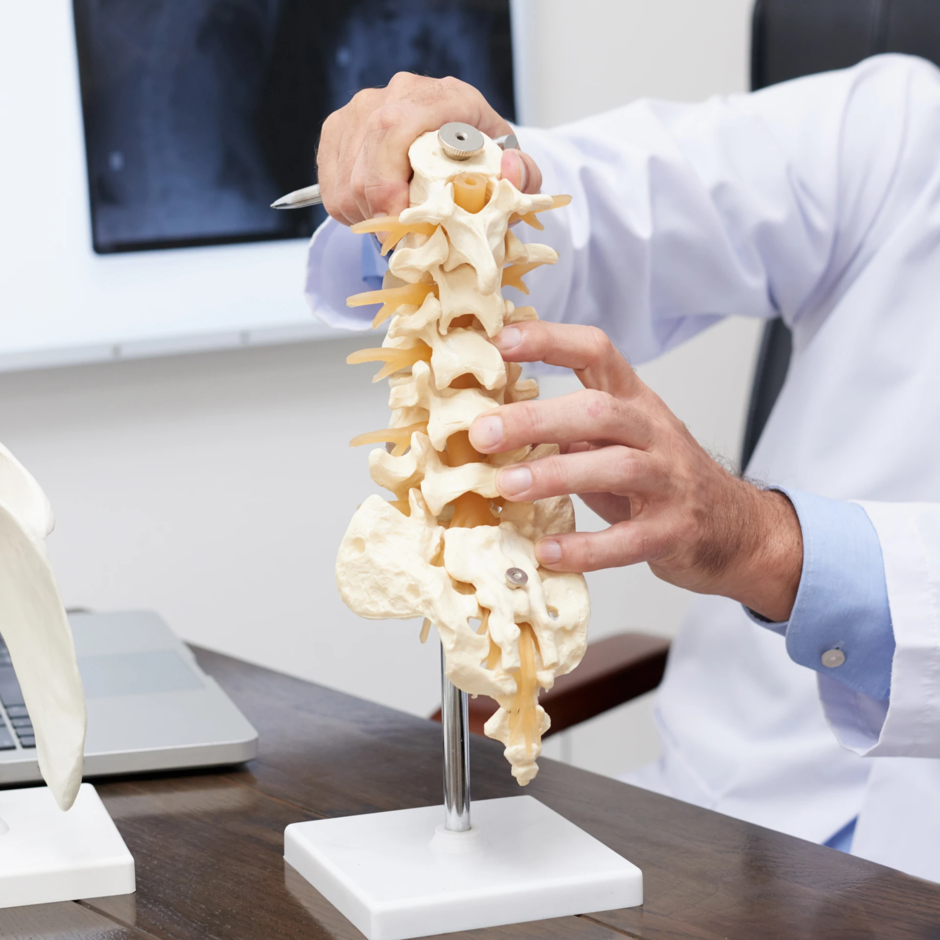 L5-S1 Disc Bulge Treatment: Physiotherapy, Medications, and Lifestyle Care