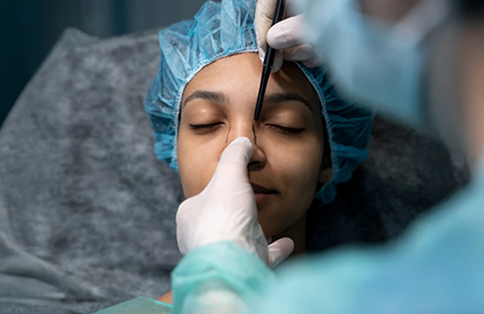 Rhinoplasty Surgery: A Comprehensive Guide to Nose Surgery in Bangalore