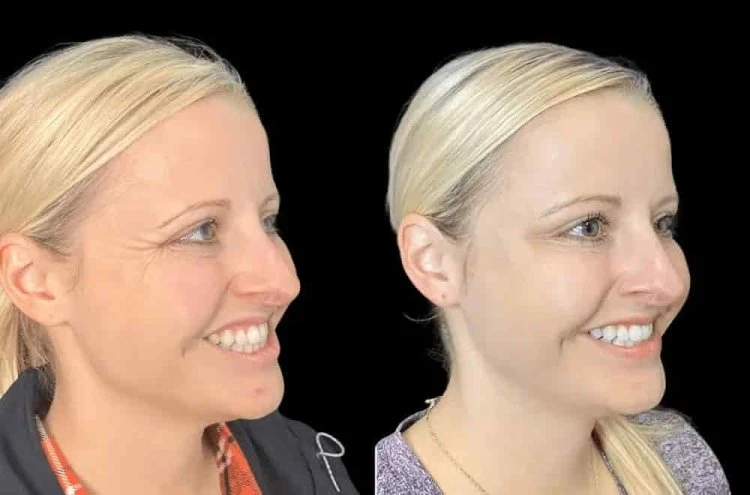 Best Doctors in Dubai for Botox Backed by Skilled and Experienced Aesthetic Specialists