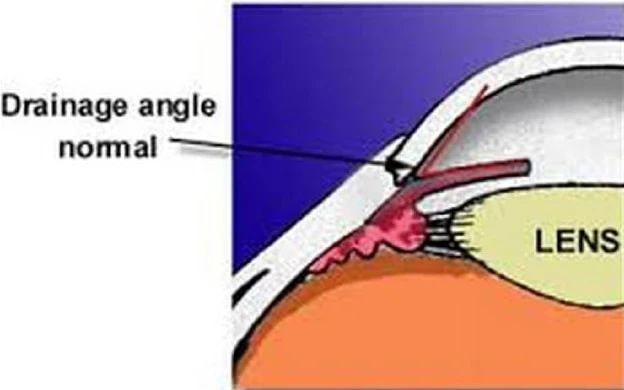 Squint Specialist Near Me and Best Glaucoma Specialist in Delhi: A Patient Guide 