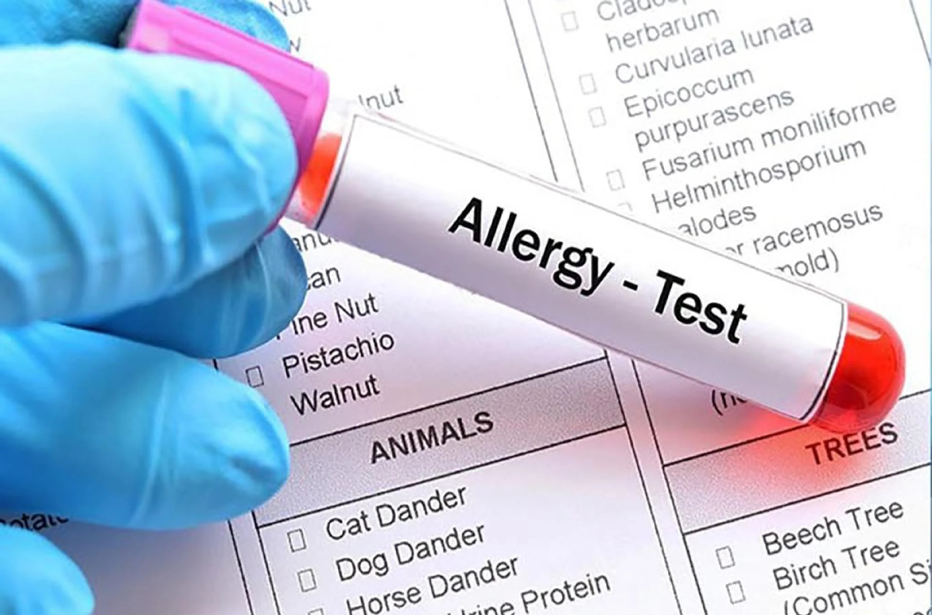 Blood test to determine food sensitivities in UAE