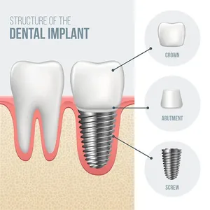 How UK Patients Can Find the Best Dental Clinic in Antalya