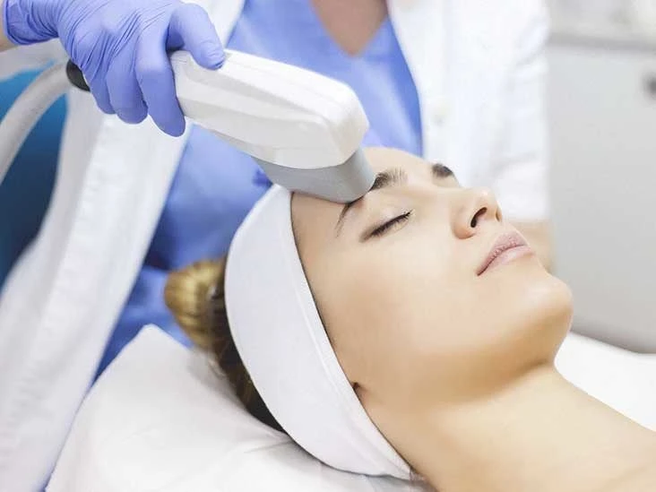 Understanding IPL Therapy in Almonte Springs: Uses, Benefits, and What to Expect