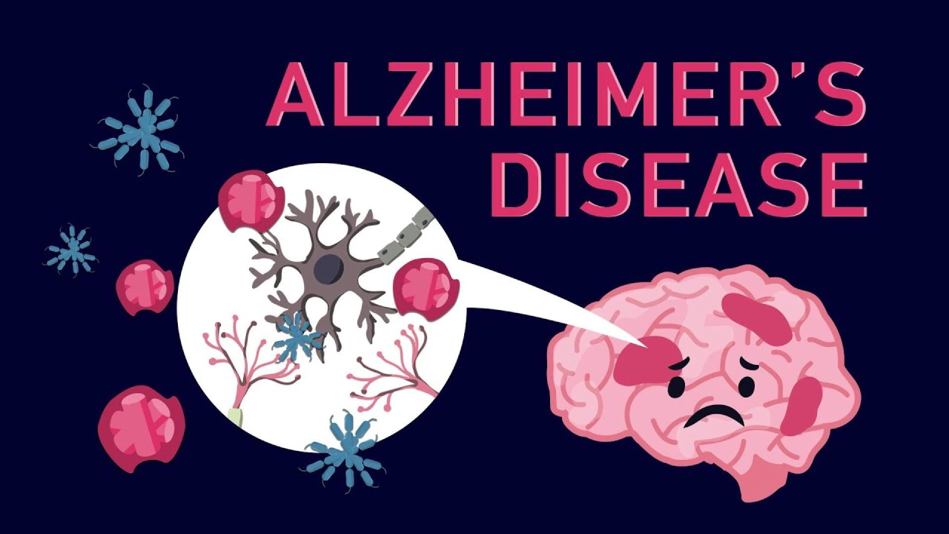 Early Detection and Management of Alzheimer’s Disease