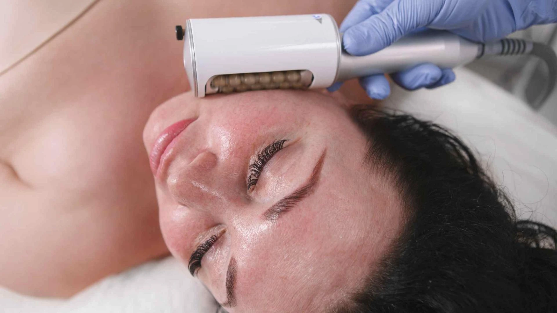 How Can the Best Depigmentation Treatment Clinic in Delhi Improve Skin Tone and Facial Glow?