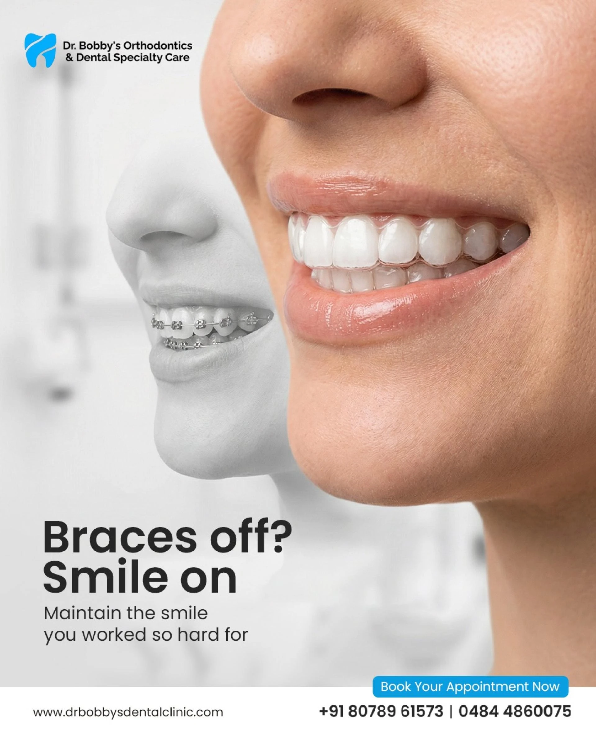 Dental Implants Cost in Kerala: A Complete Guide Before You Decide