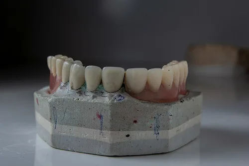 Foods to Eat and Avoid After Getting a Dental Crown