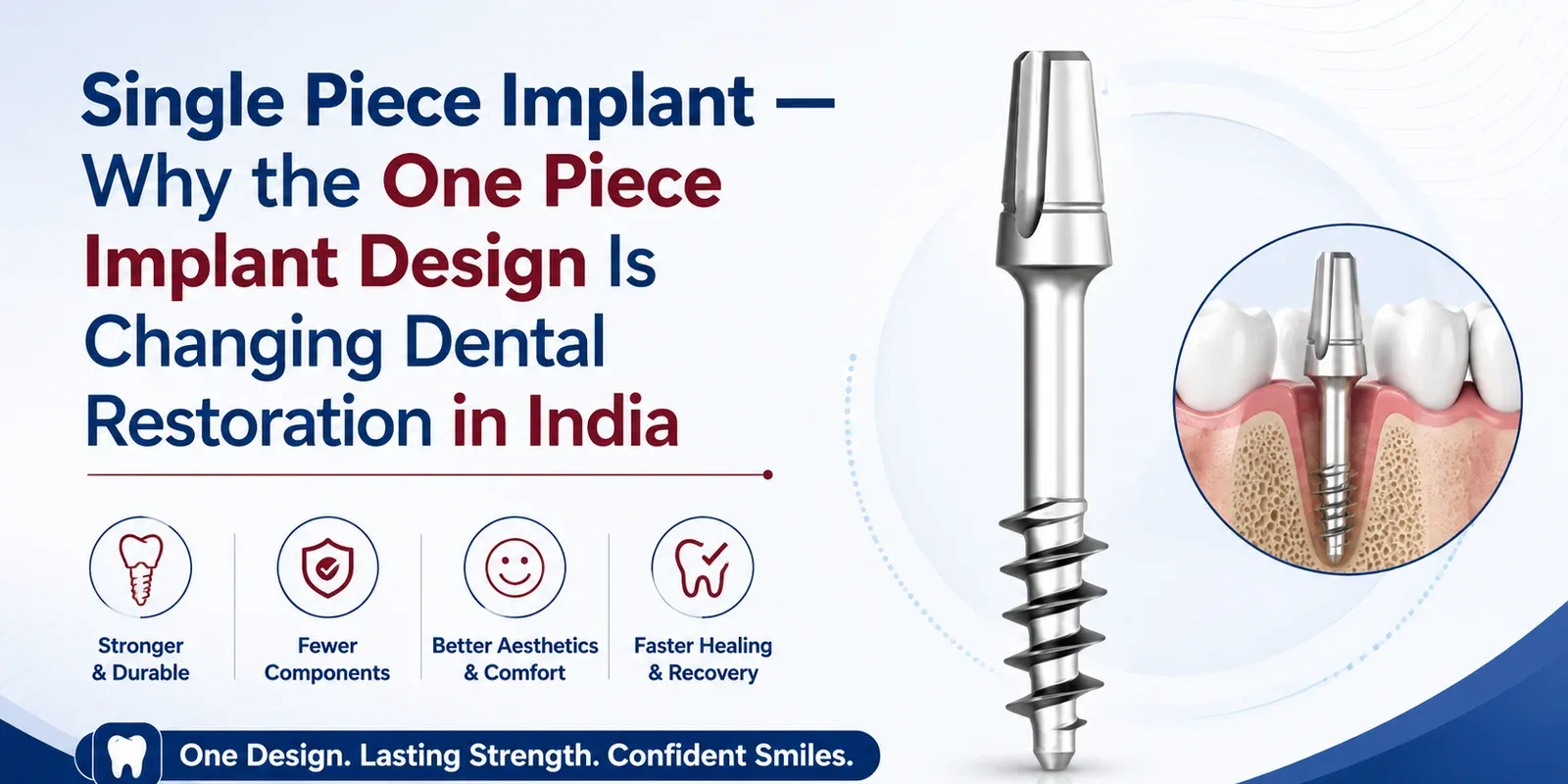 Single Piece Implant — Why the One Piece Implant Design Is Changing Dental Restoration in India
