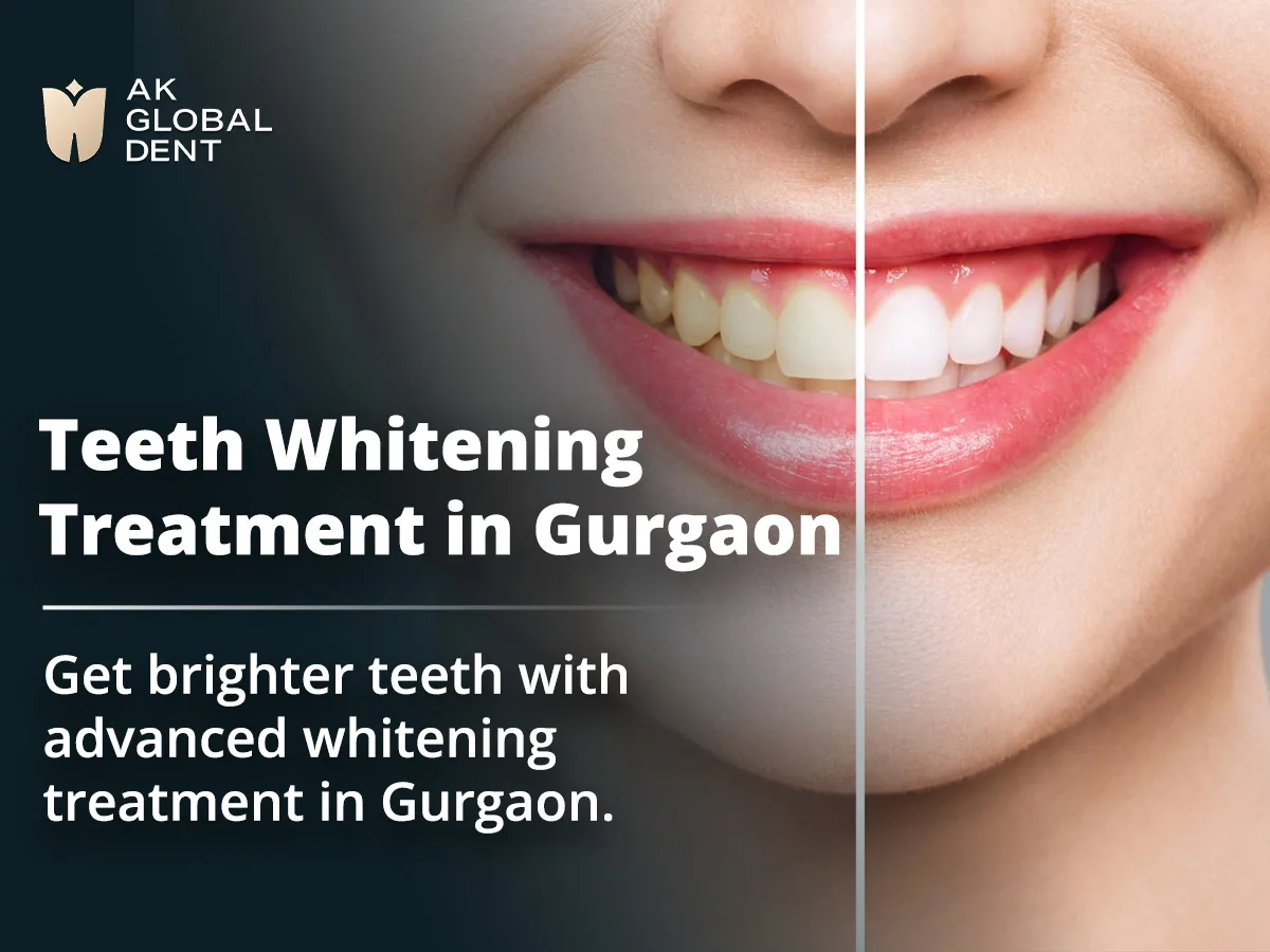 Teeth Whitening Treatment in Gurgaon: Get a Brighter Smile with Dr. Aneesh Katyal