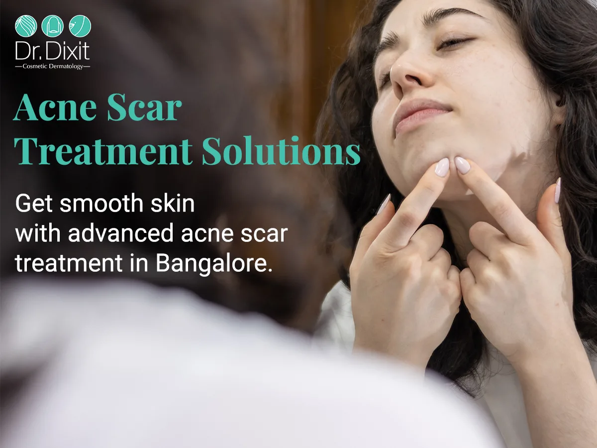 Why Are Your Acne Scars Not Improving? You May Be Treating the Wrong Type of Scar