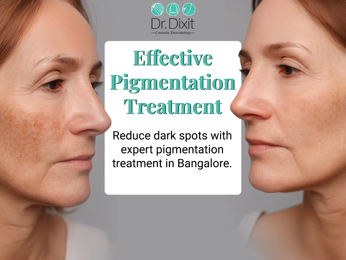 Why Does Your Pigmentation Keep Coming Back? Understanding the Real Cause