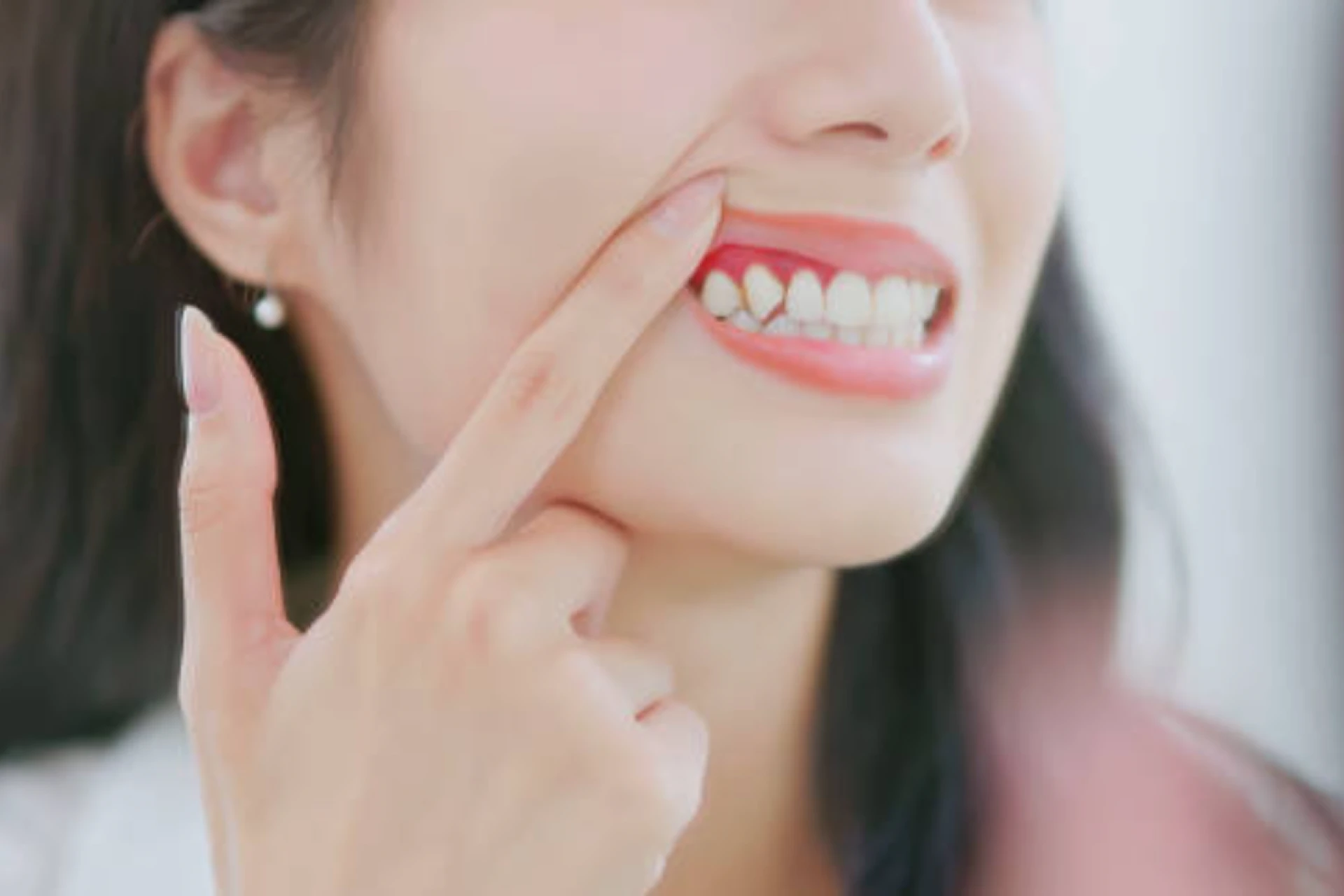 Dental Care Simplified